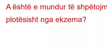 A është e mundur të shpëtojmë plotësisht nga ekzema?