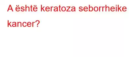 A është keratoza seborrheike kancer?