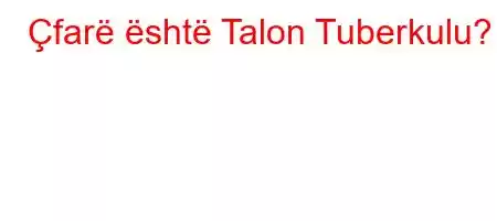 Çfarë është Talon Tuberkulu?