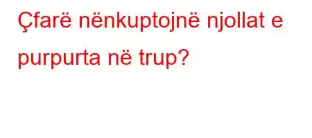 Çfarë nënkuptojnë njollat ​​e purpurta në trup?