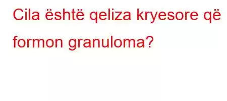 Cila është qeliza kryesore që formon granuloma?