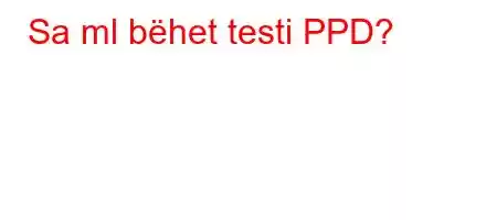 Sa ml bëhet testi PPD?