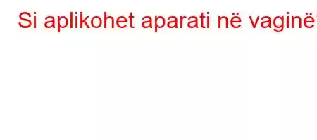 Si aplikohet aparati në vaginë