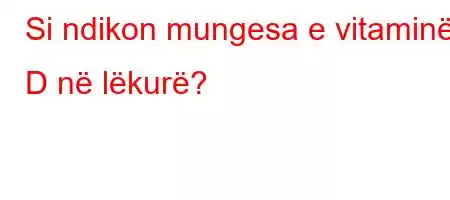 Si ndikon mungesa e vitaminës D në lëkurë?